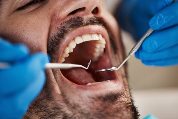 Best Emergency Treatment for Toothache in Coldwater, MI